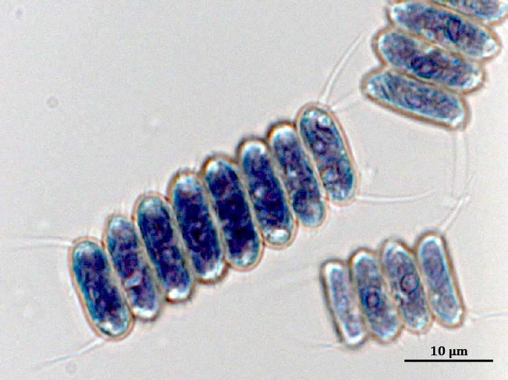Клетки Desmodesmus armatus ARC-06, окрашенные раствором Люголя. Крахмал окрашивается в сине-фиолетовый цвет. Источник: Давид Габриелян