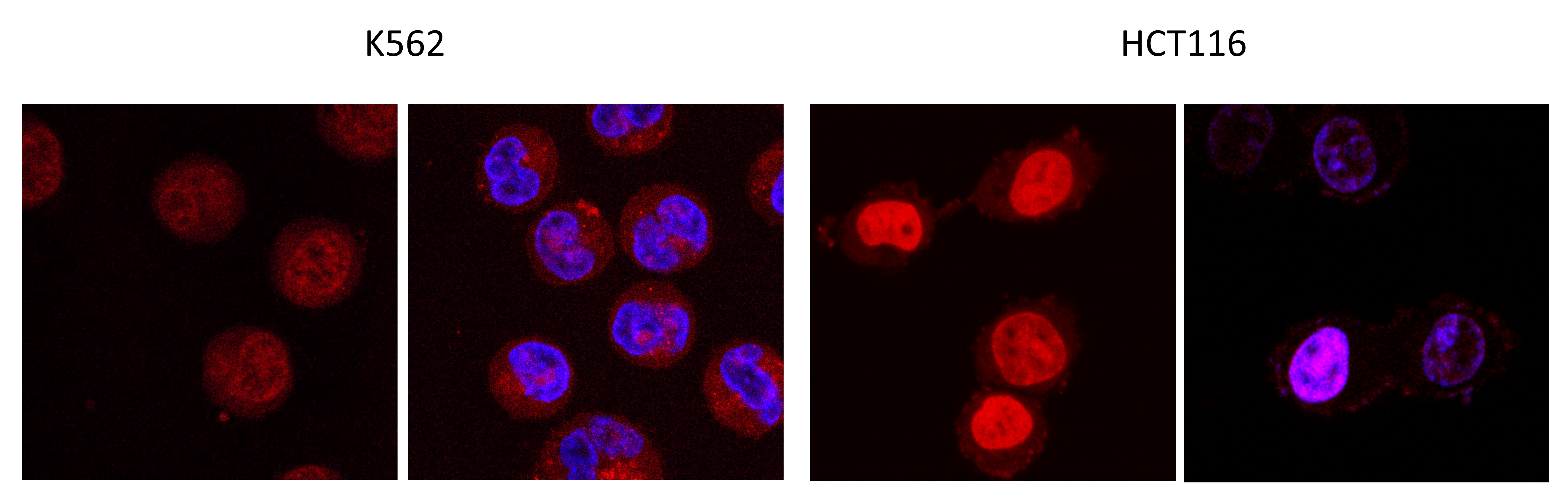 Свечение полученных соединений в ядрах раковых клеток (соединения светятся красным, ядро — синим). Источник: Александр Тихомиров / Научно-исследовательский институт по изысканию новых антибиотиков имени Г.Ф. Гаузе