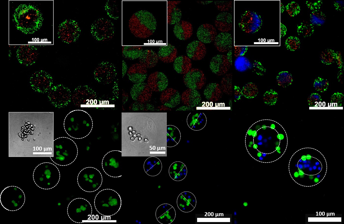 Микрофотографии альгинатных микрогелей разного строения: сверху — с микрочастицами, снизу — с живыми клетками. Источник: Pleshakov et al. / ACS Biomaterials Science & Engineering, 2025