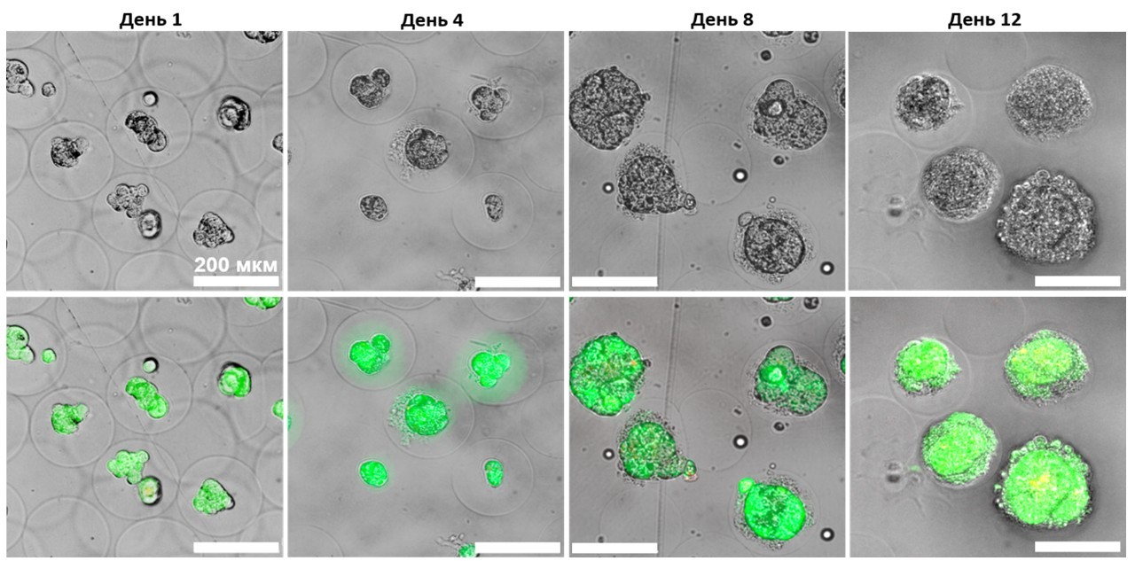 Развитие клеток в альгинатных микрогелях. Источник: Pleshakov et al. / ACS Biomaterials Science & Engineering, 2025